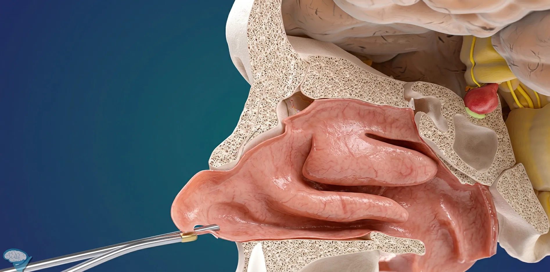 Animation 3D d’une chirurgie hypophysaire endoscopique
